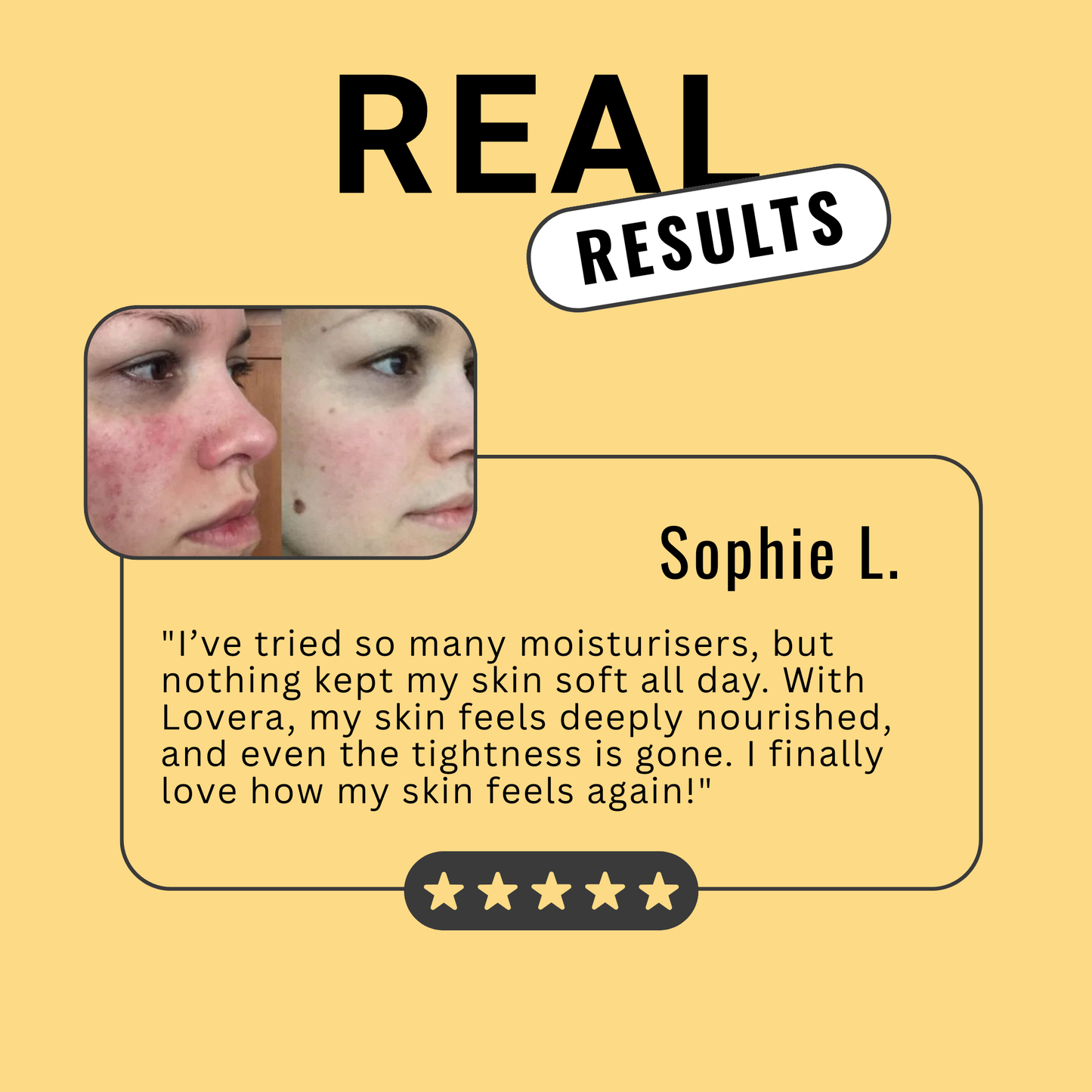 Day & Night Everything Moisturiser