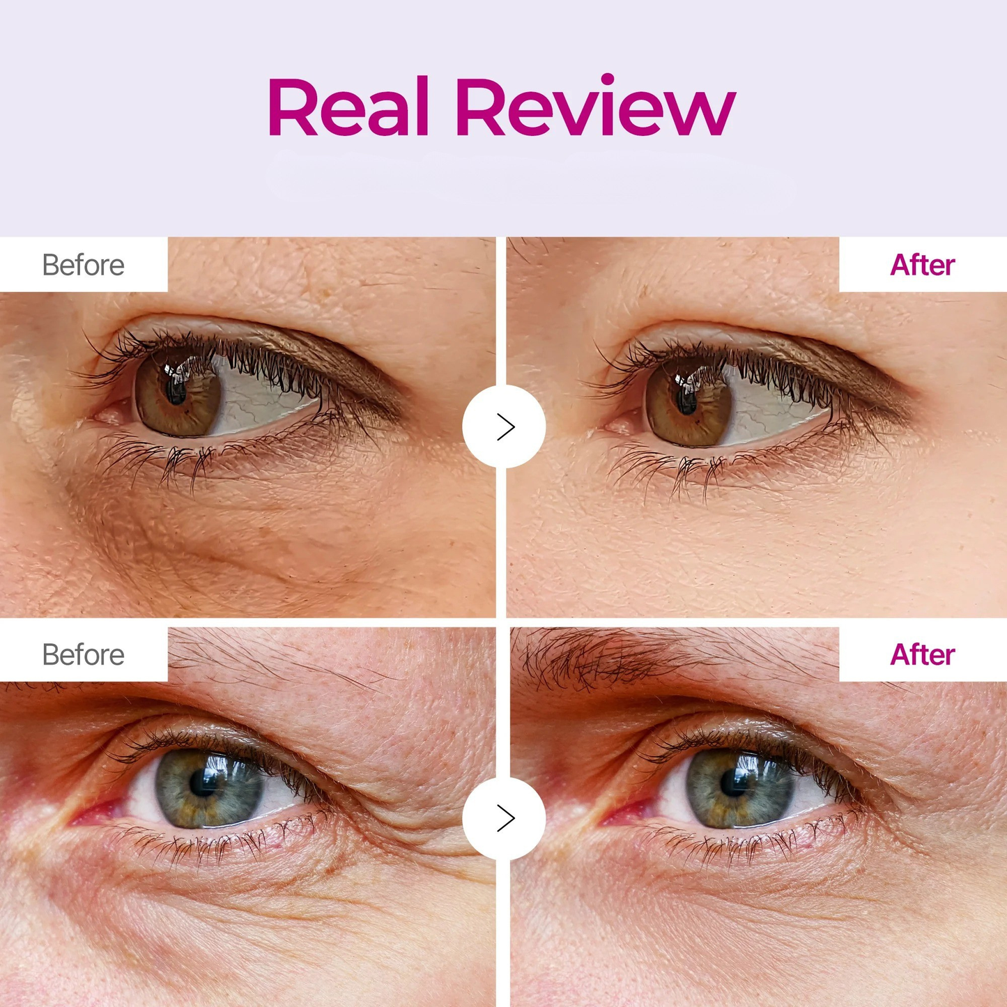 Calcium Volume Eye Patches (60)