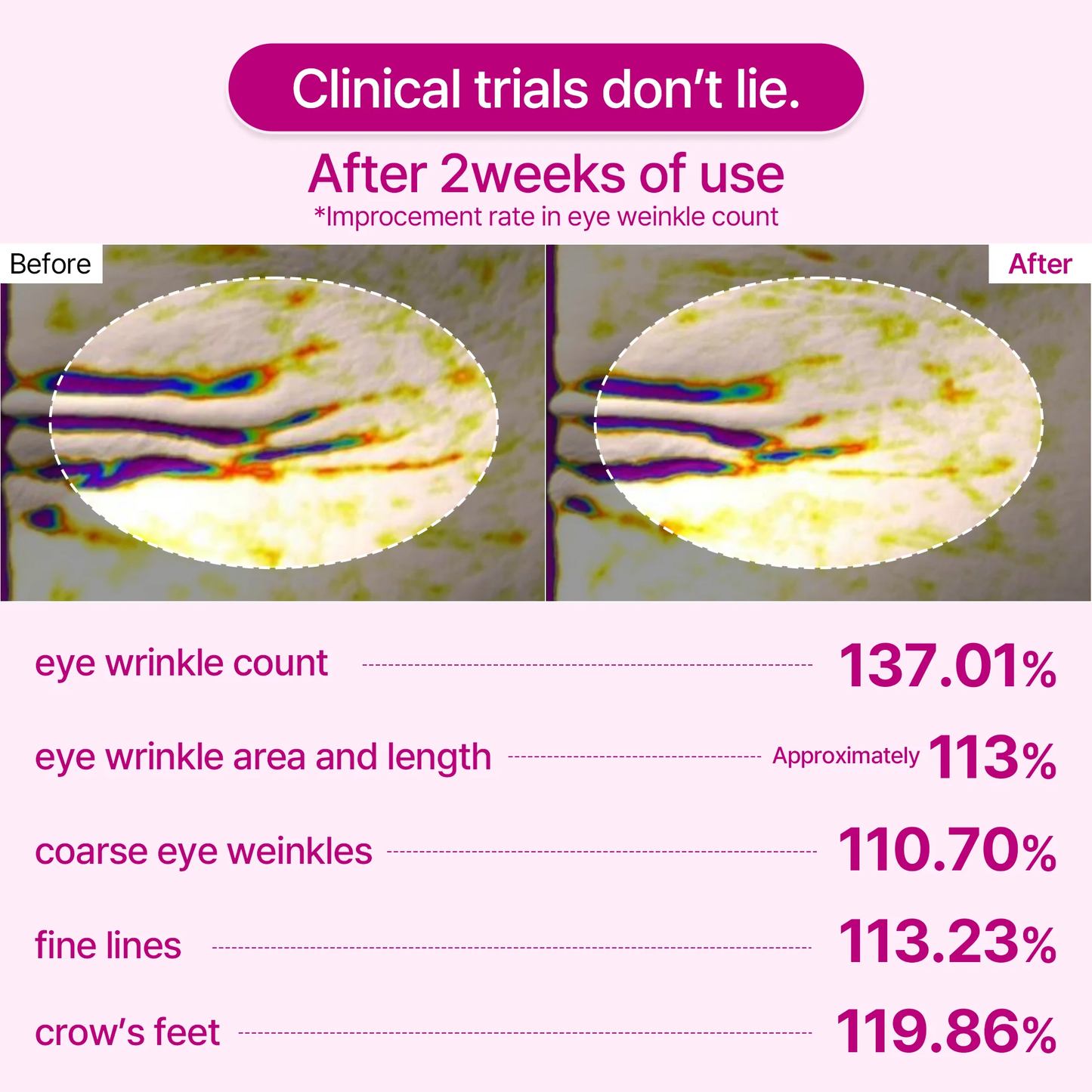 Calcium Volume Eye Patches (60)