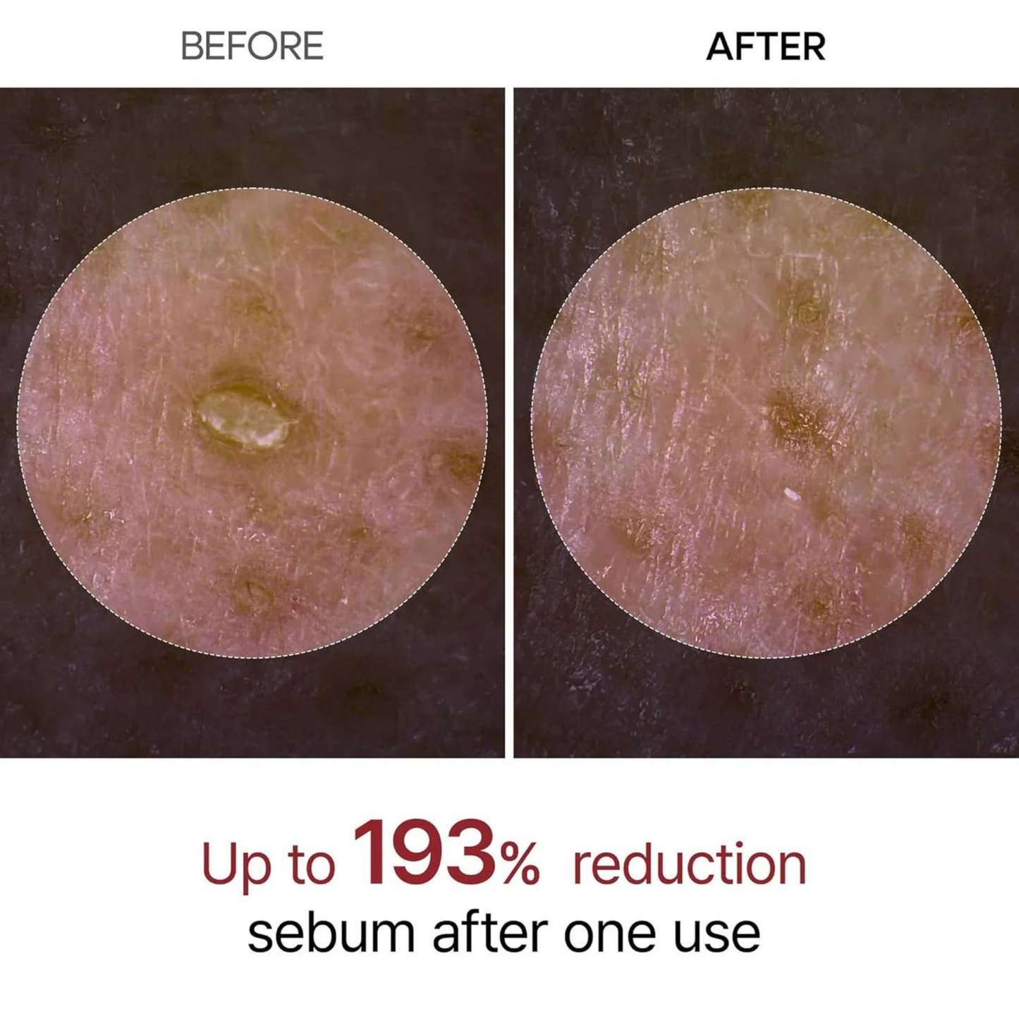 Lovera Rice Peel | Black + White Rice Set