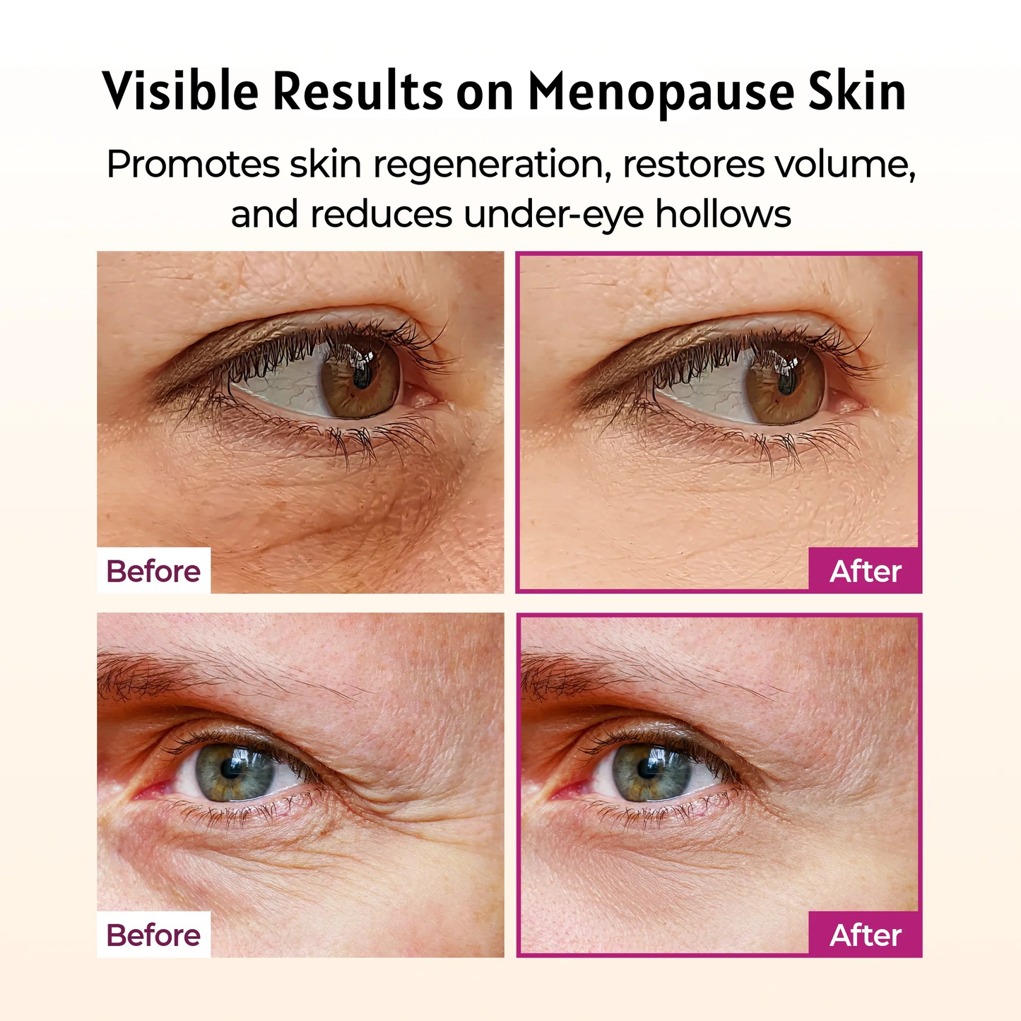 Menopause Wrinkle Recovery Balm