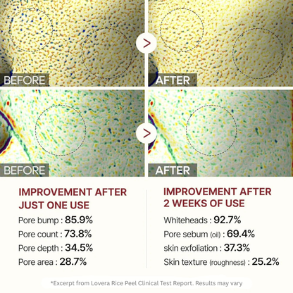 Lovera Rice Peel | Black + White Rice Set