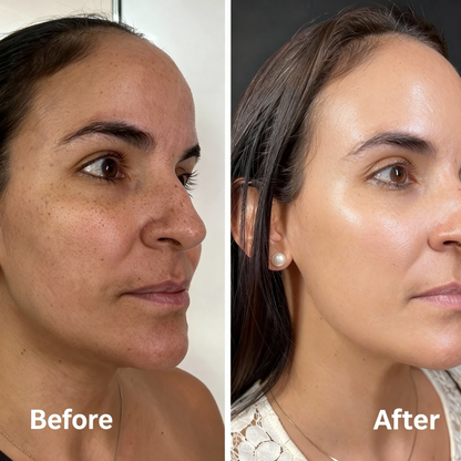 Lovera Rice Peel | Black + White Rice Set